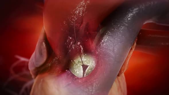 Anatomy and Function of Heart Valves