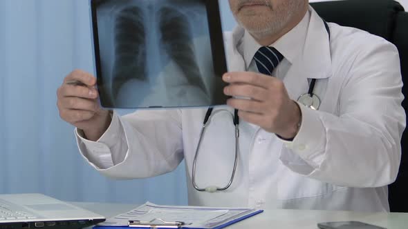 Pulmonologist Checking Patient Lung Scan, Writing Diagnosis in Medical Record