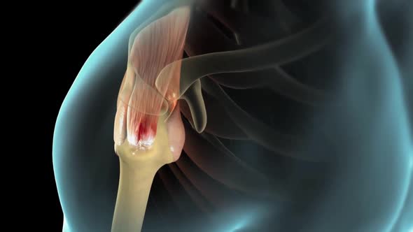 This video shows the rotator cuff