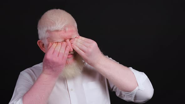 Man with Albinism Raises His Hand To Protect His Eyes From Bright Light
