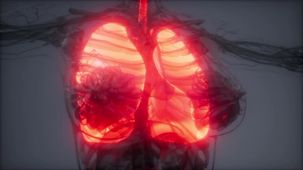 Human Lungs Radiology Exam alt