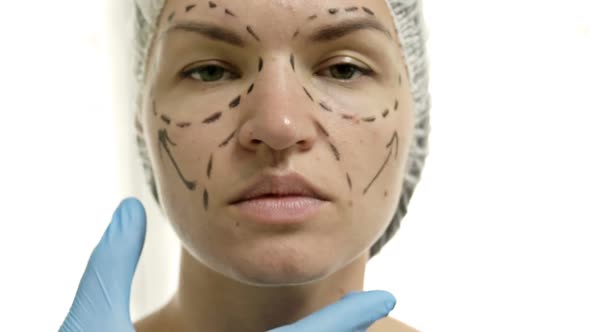 Beautiful Young Woman with Perforation Lines on Her Face Before Plastic Surgery Operation