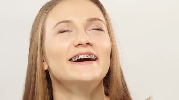 Woman with Brackets on Teeth Watch and Laughs. White. Closeup