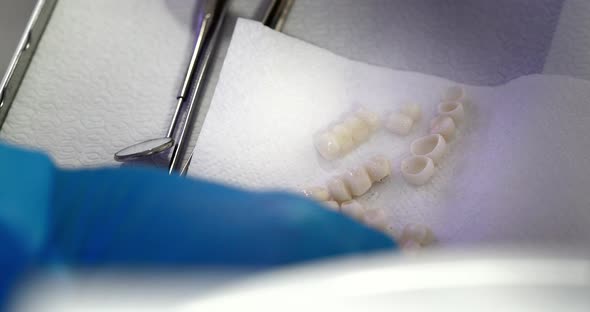 Hands of a Dentist in Medical Gloves Work with Dental Implants and Crowns in a Medical Office