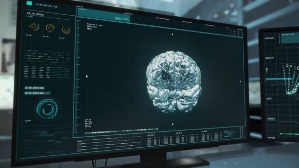 Identifying the Brain Tumor at the modern medical cancer research laboratory alt