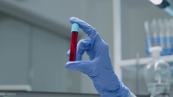 Close Up of Specialist Hand with Gloves Holding Vacutainer