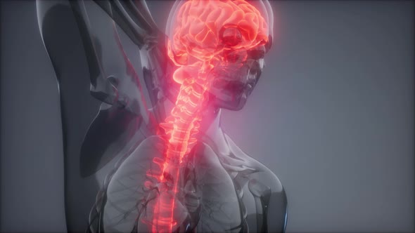 Head Pain Headache - Male Hurt Backbone alt