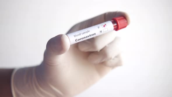 Hand in Blue Medical Gloves Holding Blood Test Tube