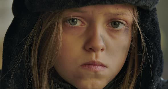 Close-up Face of Ukrainian Refugee with Grey Eyes Wearing Hat with Earflaps Looking at the Camera