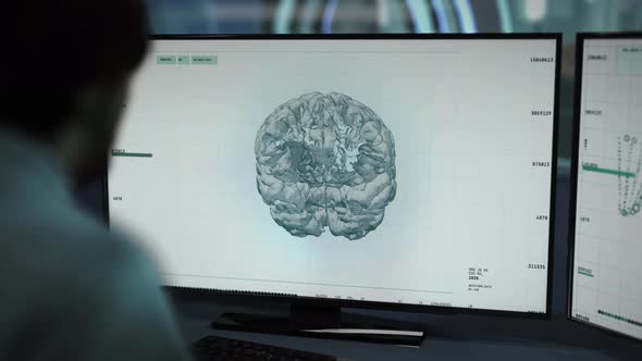Newest Diagnosis software is analyzing the brain at the health care facility alt