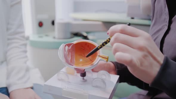 Close Up Ophthalmologist Showing the Eye Model to a Patient During a Medical Consultation in the