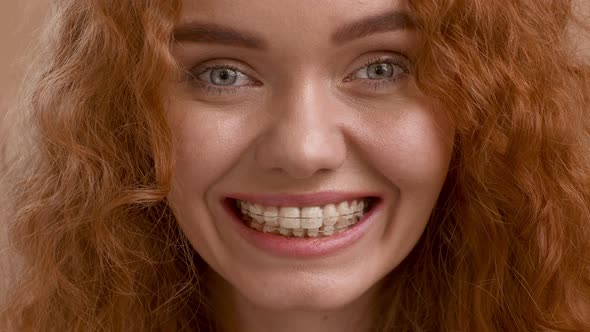 Lady With Braces Smiling Snapping Teeth Posing Over Beige Background