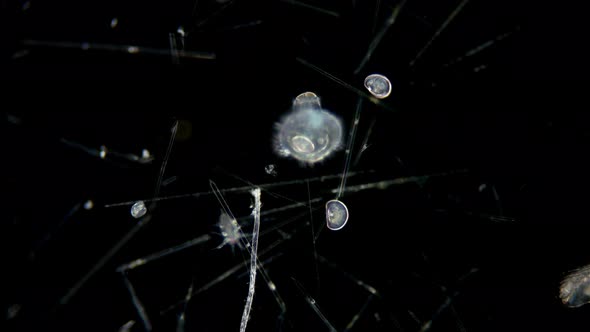 Polychaeta worm larva at metatrochophore stage under a microscope