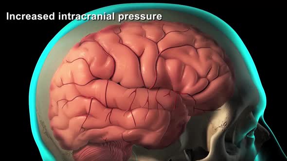 Increased intracranial pressure, brain damage and spinal cord injury