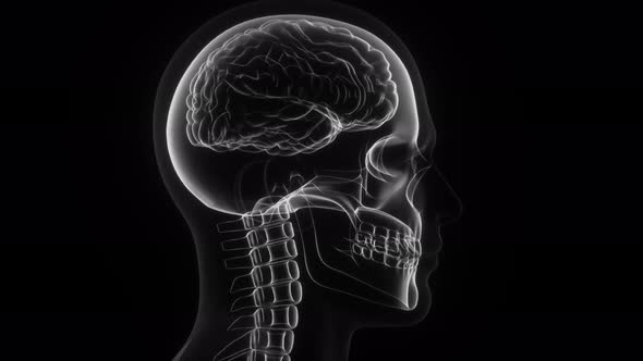 Human Head, Skull And The Brain In X-Ray