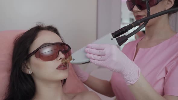 Hair Removal Over the Lip Female Face During a Laser Hair Removal Procedure