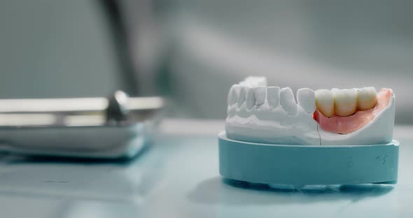 Hands of a Dentist Take a Plaster Model of Teeth