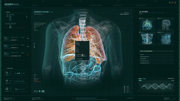 Selecting the Analysis of the Patient`s Lung using the Modern Research Software alt