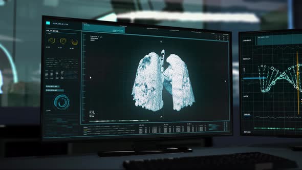 Detecting Covid-19 Pneumonia Virus in the DNA Structure of the Patient`s Lungs