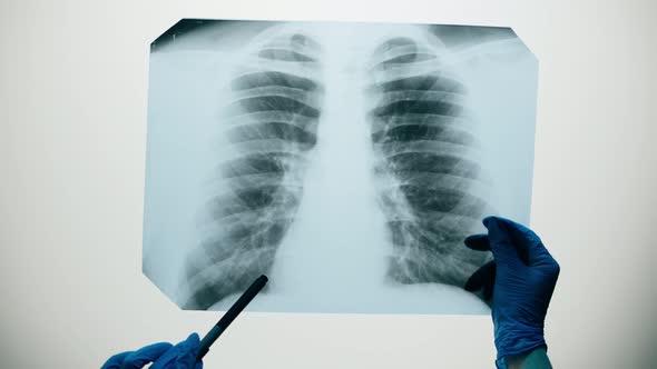 Lungs Xray Closeup