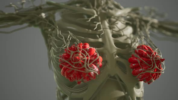 Medical Scan of Woman Breast Cancer alt