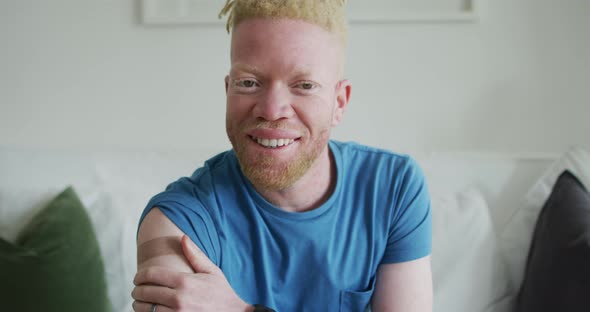 Happy albino african american man with dreadlocks and a plaster after vaccination