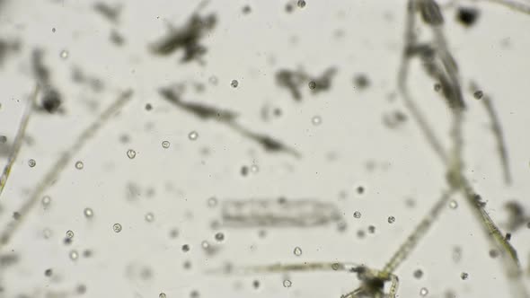 colony of planktonic ciliates Halteria rubra under a microscope 