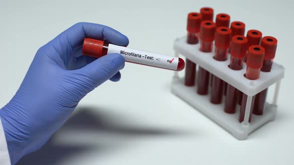 Positive Microfilaria Test, Doctor Showing Blood Sample in Tube, Health Checkup