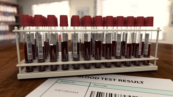 Medical Form with Virus Positive Blood Analysis