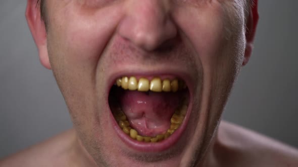 A man with yellow teeth aggressively grins. Negative emotions on the face. 