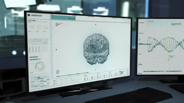 Innovative Medical Software Shows Human Brain Diagnosis Results At Hospital