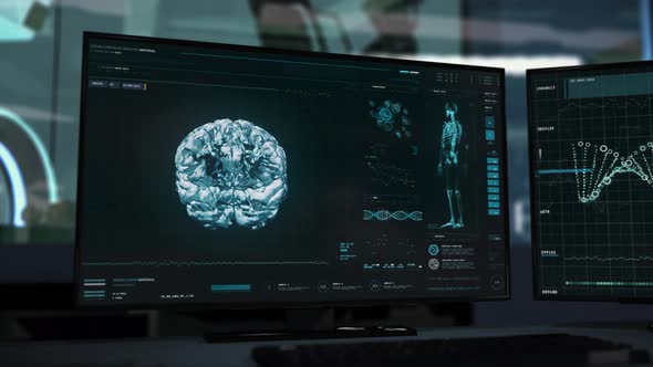 Futuristic examination computer system found dangerous tumor in the human brain