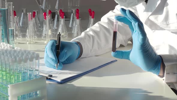 Virus. Blood Sample in Researcher's Hands. Disease Blood.