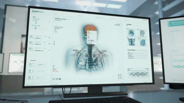 Futuristic Medical Interface Technology Examines Patients Brain For Tumor alt