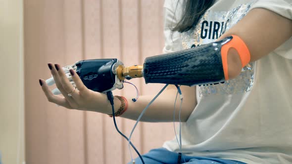 Robotic Limb, Prosthesis. Girl Use Bionic 3d Printed Arm for the First Time