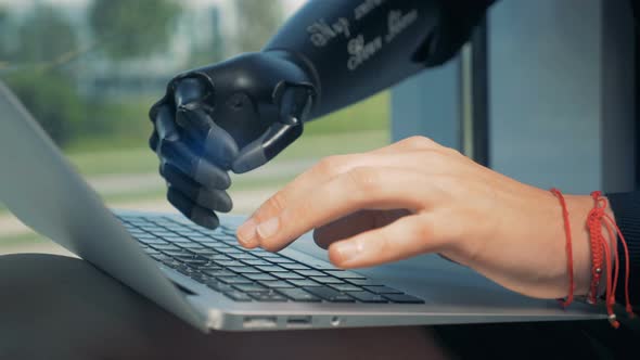 Man Works with a Laptop, Wearing a Bionic Hand. Cyborg Concept