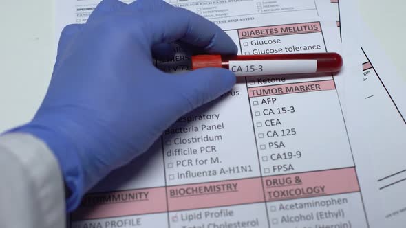 CA 15-3, Doctor Checking Disease in Lab Blank, Showing Blood Sample in Tube