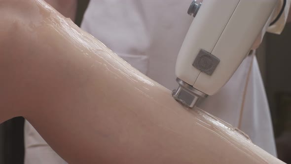 Leg Laser Epilation Procedure