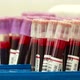 Test tubes. Blood transfusion station. Blood donor. Operation. Hospital. A heart. - VideoHive Item for Sale