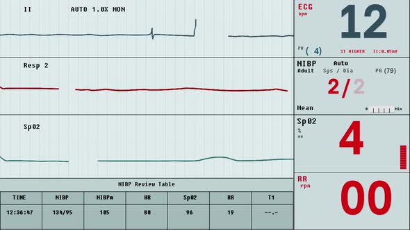 Modern Medical equipment identifies the rapid increase of the heart rhythm