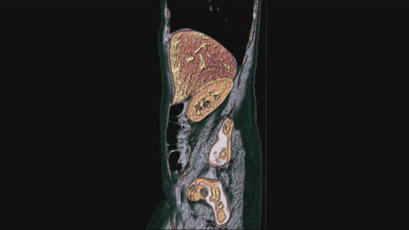 Bulk Multicolored MRI of the Female Pelvic Organs, Abdominal Cavity, Gastrointestinal Tract and