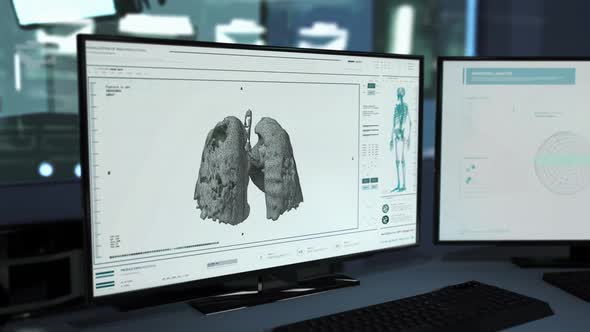 Coronavirus Pandemic Laboratory Analyses Pneumonia Lung Disease X-ray Scan alt