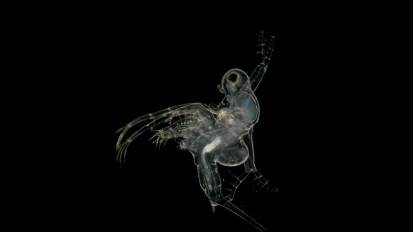 Zooplankton Under a Microscope, Prickly Water Flea