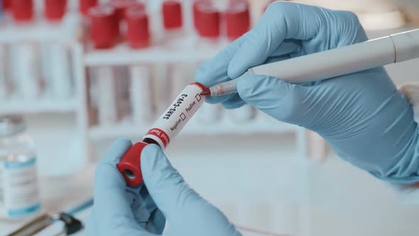 Close Up of Doctors Hand Holding Tube with Positive Blood Test for SARS-CoV-3