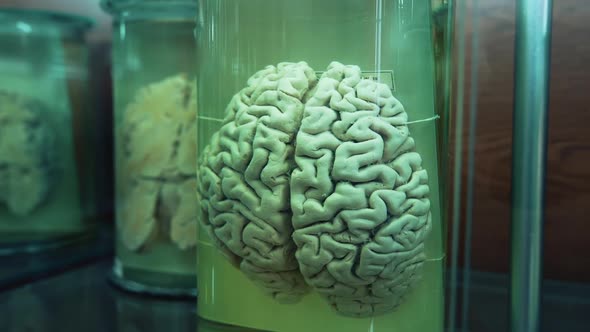 Organs in anatomical museum