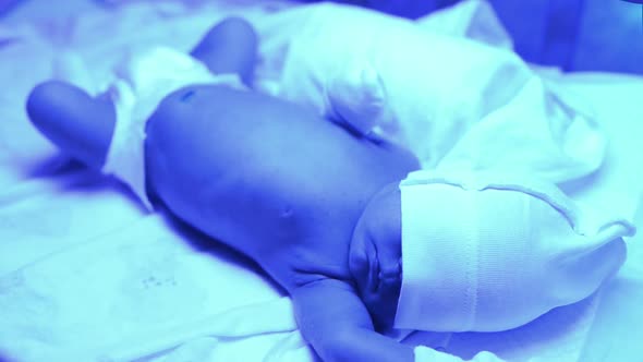 Newborn Having a Treatment for Jaundice Under Ultraviolet Lamp in Home Bed