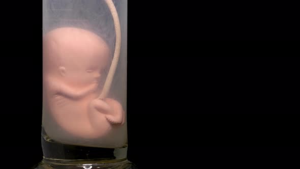 Human Embryo Model in Vitro