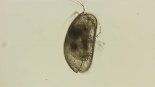 Crustacea Ostracoda Under the Microscope