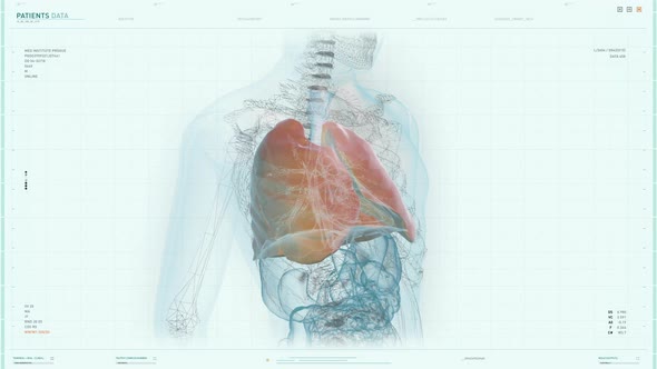 X-Ray Image Of Human Body Is Analyzed In Software For Diagnostic Purposes