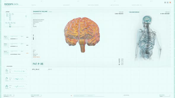 Innovative Biotechnology X-ray Examination Interface Conducts Analysis Of Brain alt